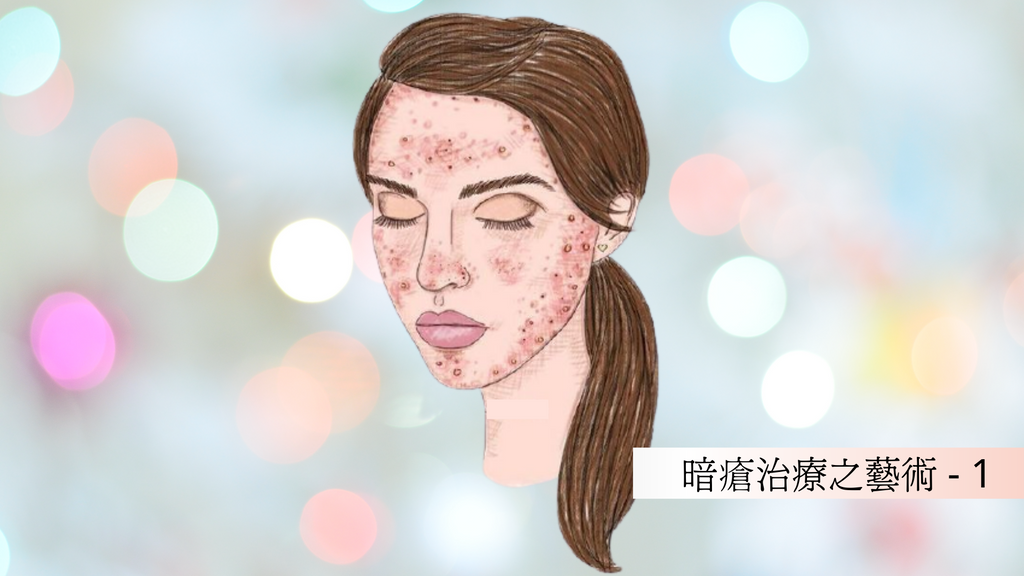 暗瘡治療之藝術 (1)│Blog.BeautyAcademyHK.com – BEAUTY ACADEMY HK